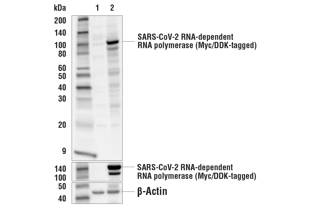 Western Blotting Image 1: SARS-CoV-2 RNA-dependent RNA Polymerase Antibody