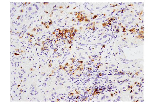 Immunohistochemistry Image 1: GITR (D9I9D) Rabbit mAb (IHC Preferred)