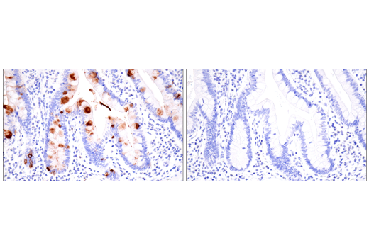 Immunohistochemistry Image 9: CA 19-9 (C241:5:1:4) Mouse mAb