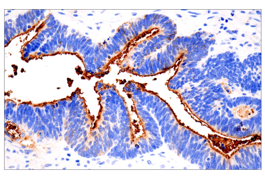 Immunohistochemistry Image 2: CA 19-9 (C241:5:1:4) Mouse mAb