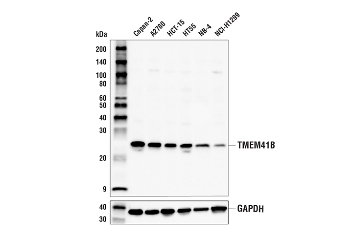 Western Blotting Image 1: TMEM41B Antibody
