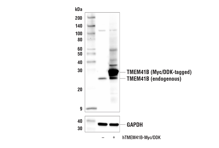 Western Blotting Image 2: TMEM41B Antibody