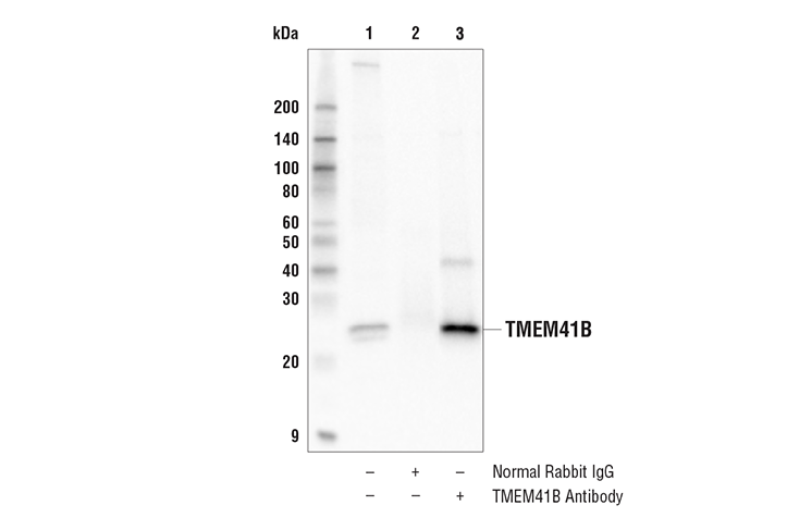 Immunoprecipitation Image 1: TMEM41B Antibody
