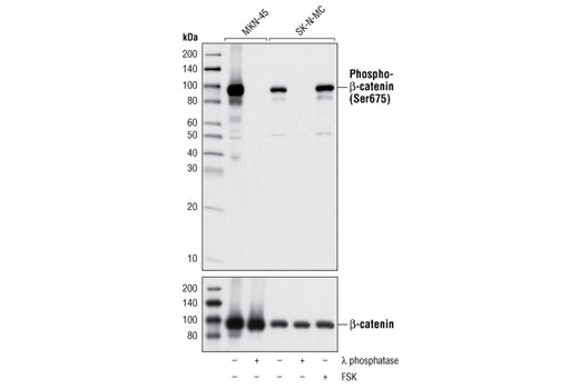 Western Blotting Image 2: Phospho-β-Catenin (Ser675) (D2F1) XP® Rabbit mAb (BSA and Azide Free)