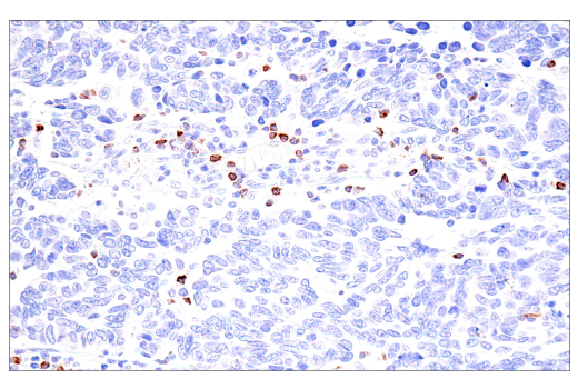 Immunohistochemistry Image 5: GNLY (E2T3D) Rabbit mAb