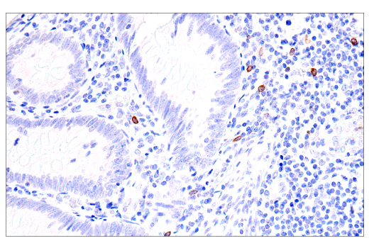 Immunohistochemistry Image 7: GNLY (E2T3D) Rabbit mAb