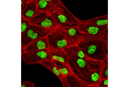 Immunofluorescence Image 1: KAP-1 (C42G12) Rabbit mAb (BSA and Azide Free)