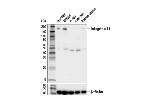 Western Blotting Image 1: Integrin α11 Antibody