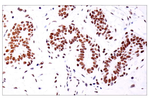 Immunohistochemistry Image 3: PBRM1/BAF180 (D4L9X) Rabbit mAb (BSA and Azide Free)