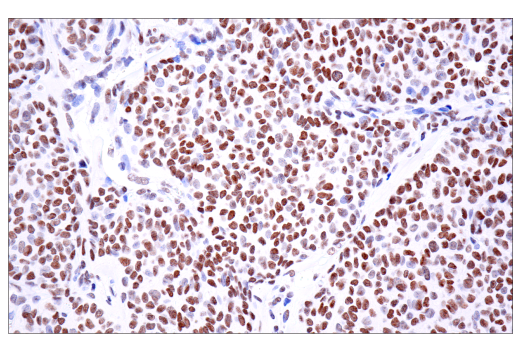 Immunohistochemistry Image 7: PBRM1/BAF180 (D4L9X) Rabbit mAb (BSA and Azide Free)
