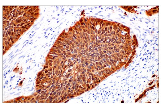 Immunohistochemistry Image 3: p16 INK4A (BC42) Mouse mAb
