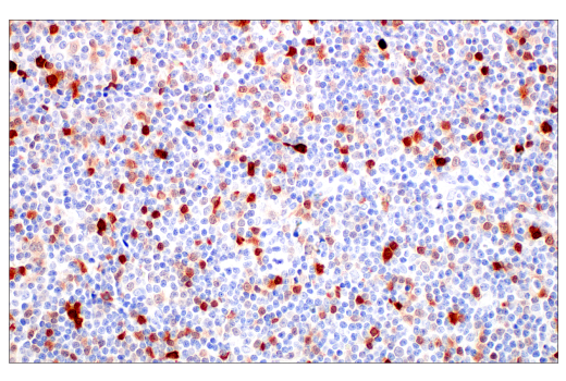 Immunohistochemistry Image 6: p16 INK4A (BC42) Mouse mAb