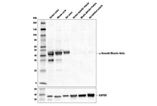 Western Blotting Image 1: α-Smooth Muscle Actin (D4K9N) XP® Rabbit mAb (HRP Conjugate)