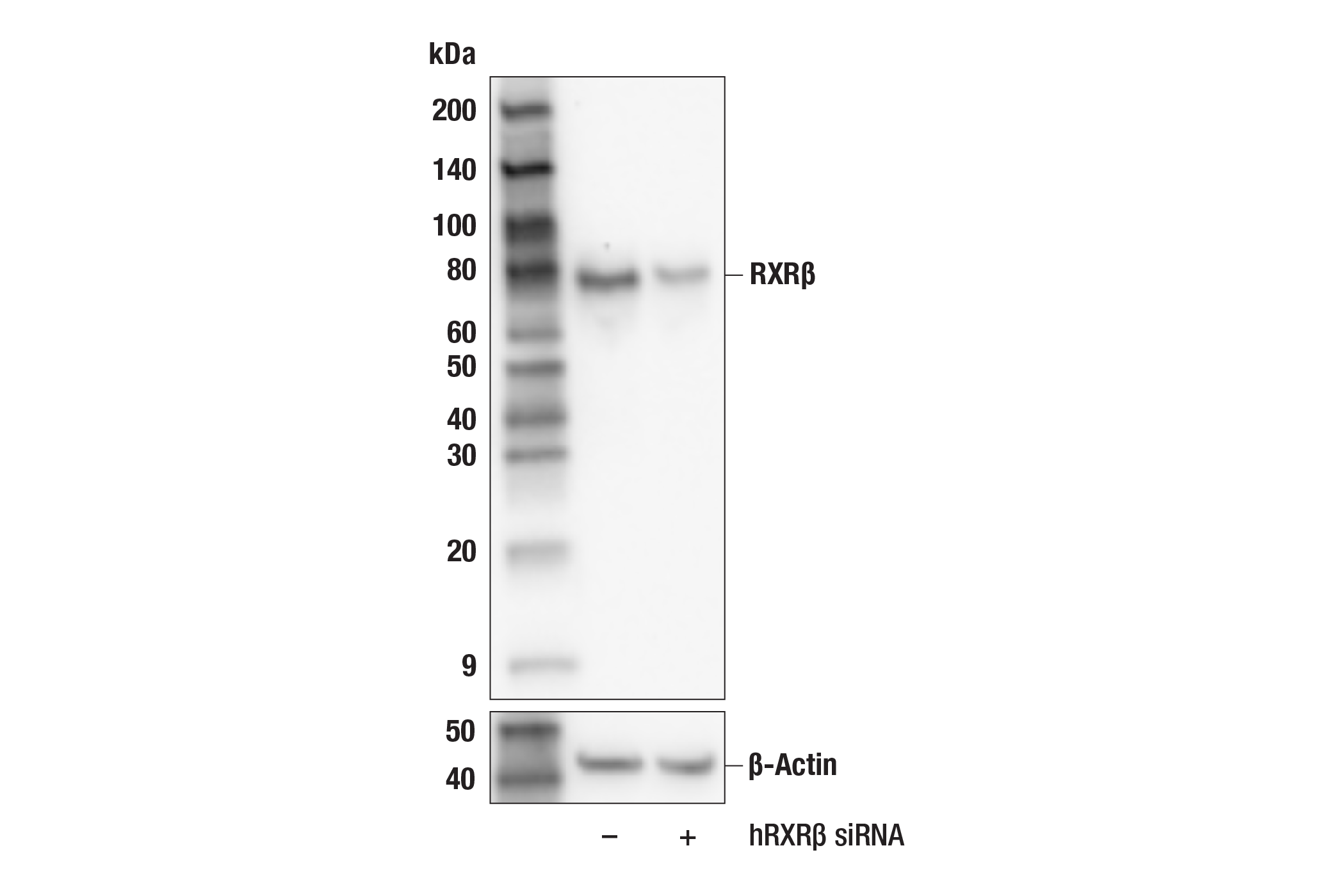 Western Blotting Image 2: RXR beta (F2O7C) Rabbit Monoclonal Antibody