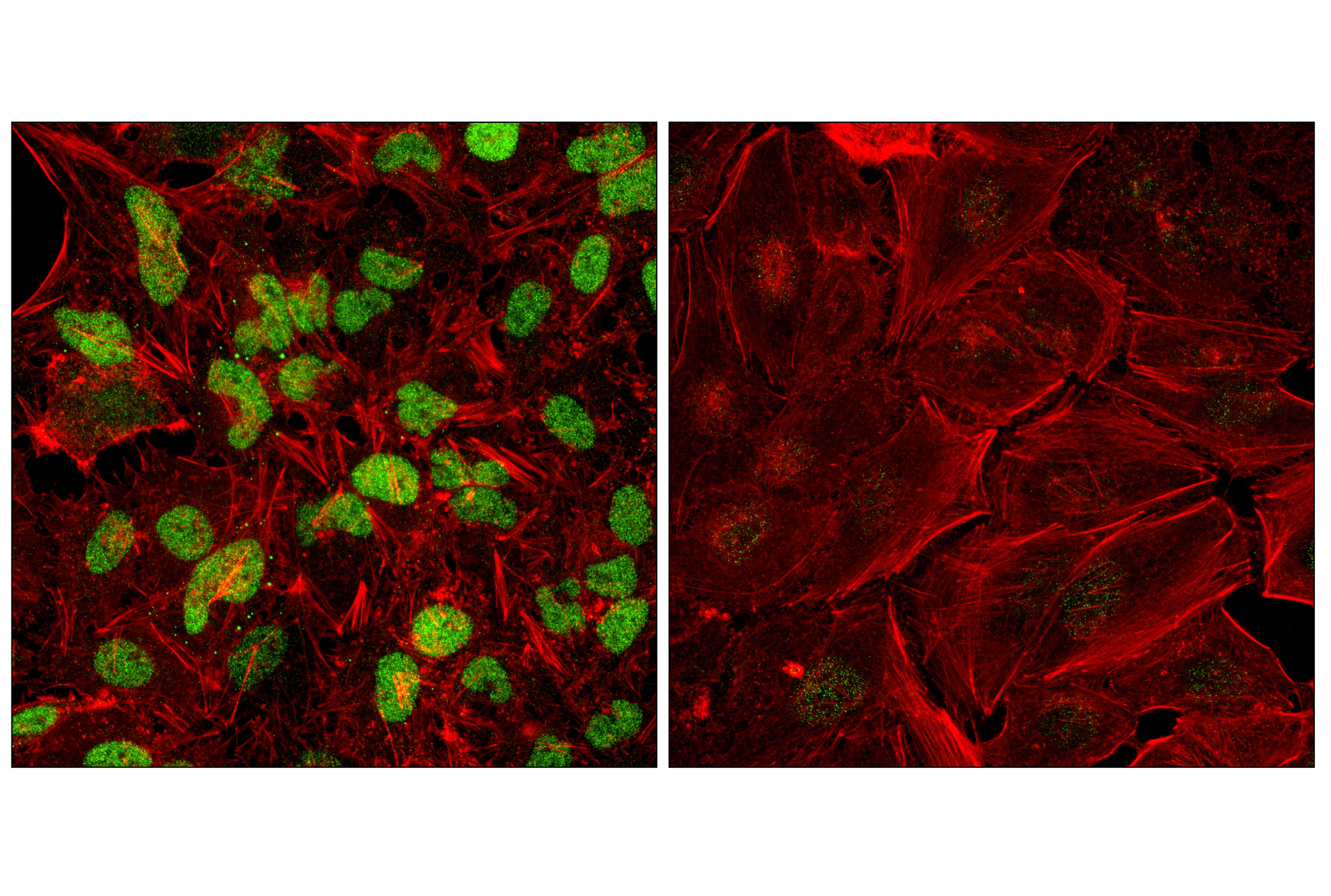 Immunofluorescence Image 1: RXR beta (F2O7C) Rabbit Monoclonal Antibody