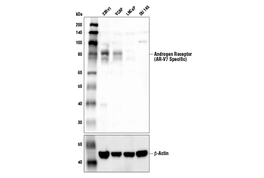 Western Blotting Image 1: Androgen Receptor (AR-V7 Specific) Antibody