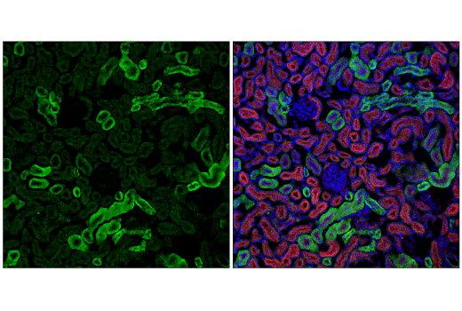 Immunofluorescence Image 2: Occludin (6B8A3) Rat mAb