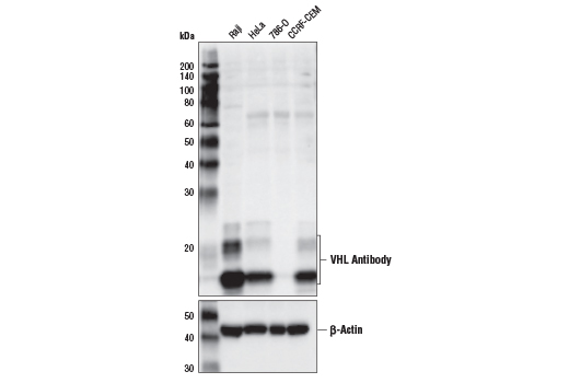 Image 4: PROTAC E3 Ligase Profiling Antibody Sampler Kit