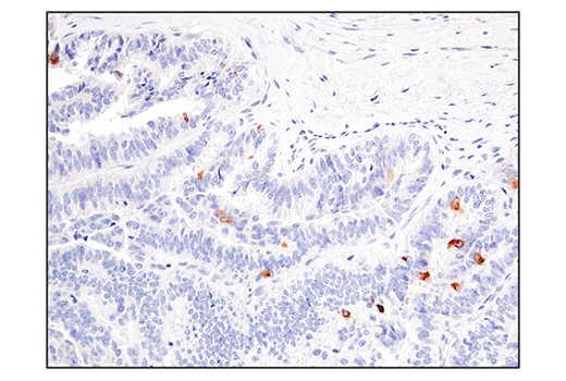 Immunohistochemistry Image 1: IL-13RA2/CD213a2 (E7U7B) Rabbit mAb (BSA and Azide Free)