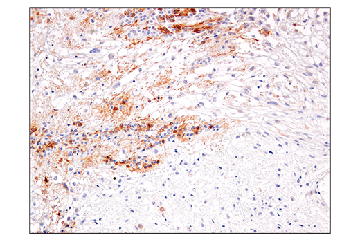 Immunohistochemistry Image 2: IL-13RA2/CD213a2 (E7U7B) Rabbit mAb (BSA and Azide Free)