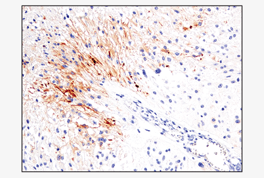 Immunohistochemistry Image 3: IL-13RA2/CD213a2 (E7U7B) Rabbit mAb (BSA and Azide Free)