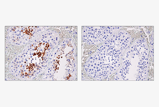 Immunohistochemistry Image 5: IL-13RA2/CD213a2 (E7U7B) Rabbit mAb (BSA and Azide Free)