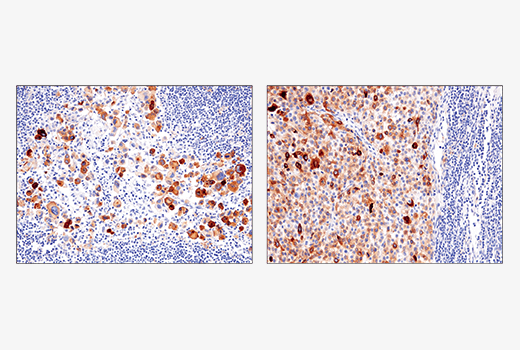 Immunohistochemistry Image 7: IL-13RA2/CD213a2 (E7U7B) Rabbit mAb (BSA and Azide Free)