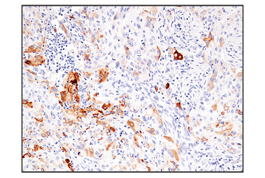 Immunohistochemistry Image 4: IL-13RA2/CD213a2 (E7U7B) Rabbit mAb (BSA and Azide Free)