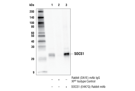 Immunoprecipitation Image 1: SOCS1 (E4K7Q) Rabbit mAb