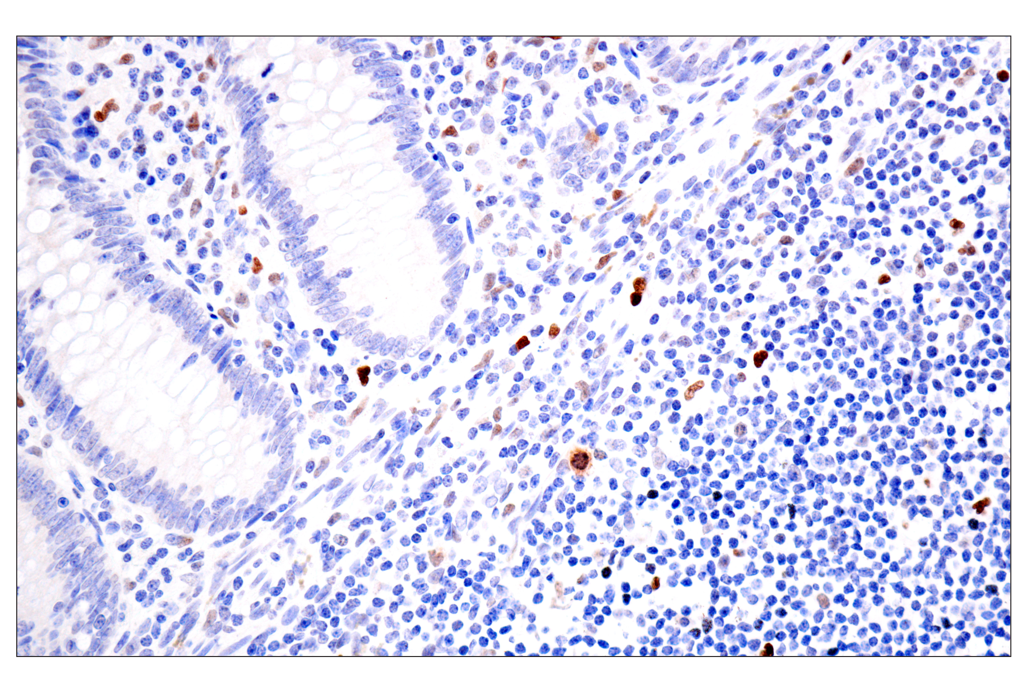 Immunohistochemistry Image 10: BATF3 (E3F3L) Rabbit mAb (BSA and Azide Free)