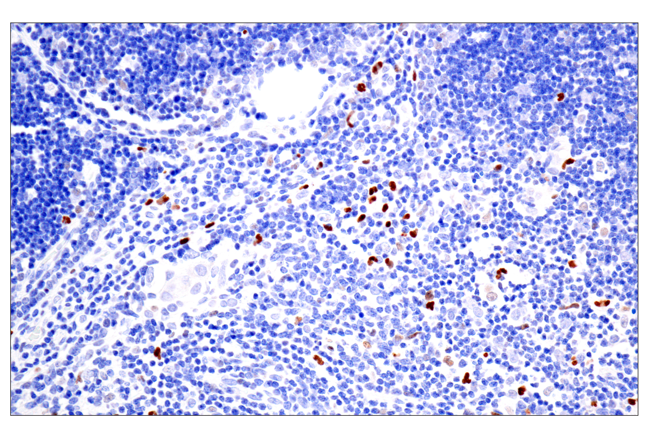 Immunohistochemistry Image 7: BATF3 (E3F3L) Rabbit mAb (BSA and Azide Free)