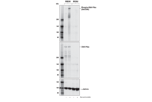 Western Blotting Image 1: Phospho-DNA-PKcs (Ser2056) (E9J4G) Rabbit mAb