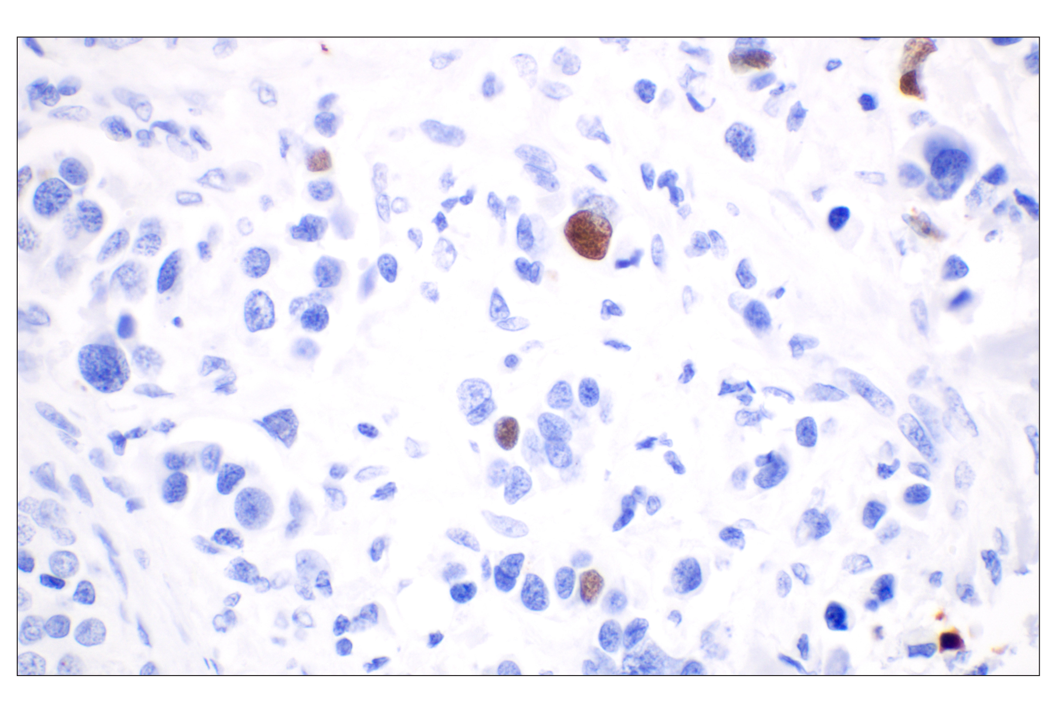  Image 13: Non-Homologous End Joining (NHEJ) DNA Repair Antibody Sampler Kit