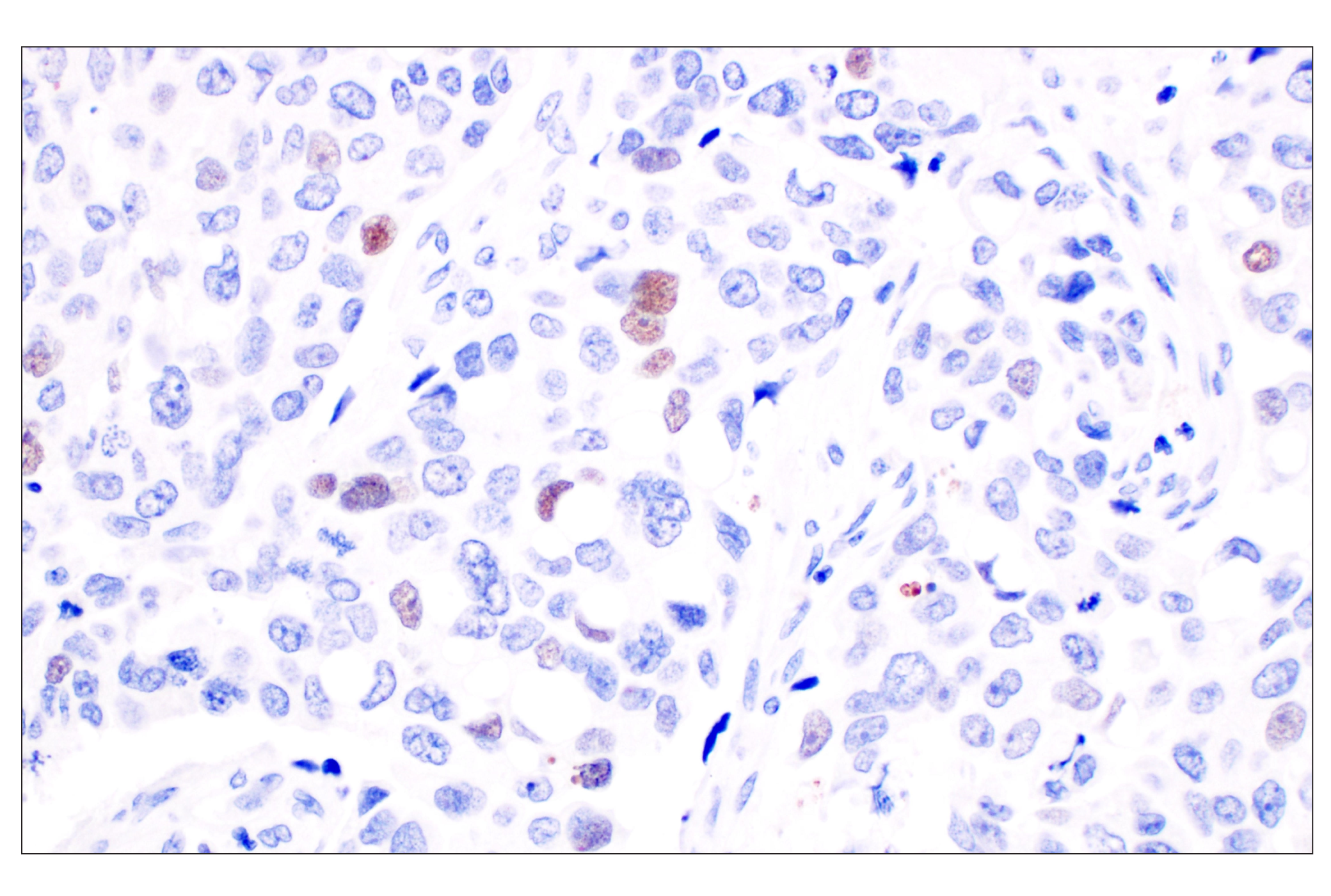  Image 16: Non-Homologous End Joining (NHEJ) DNA Repair Antibody Sampler Kit