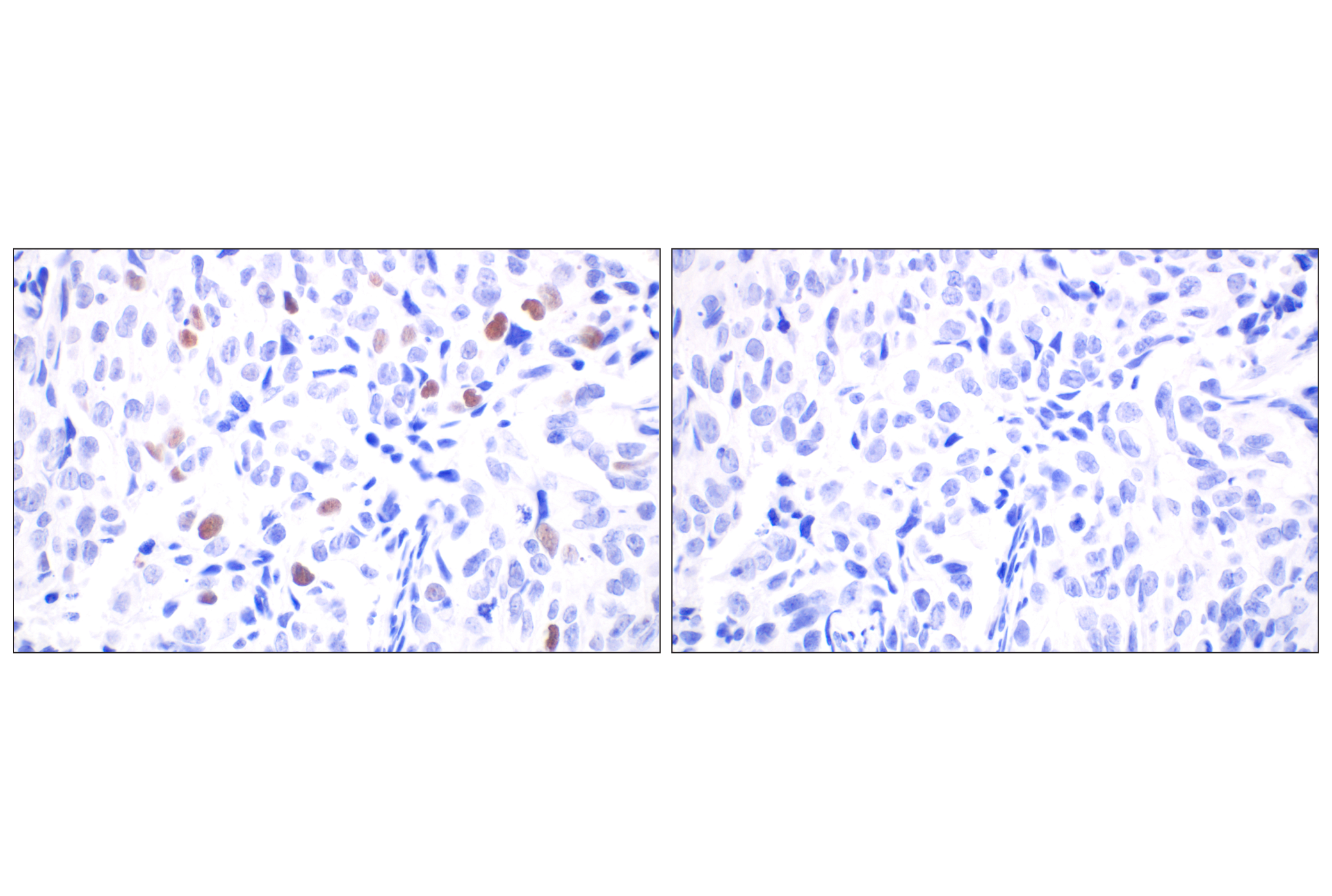  Image 23: Non-Homologous End Joining (NHEJ) DNA Repair Antibody Sampler Kit