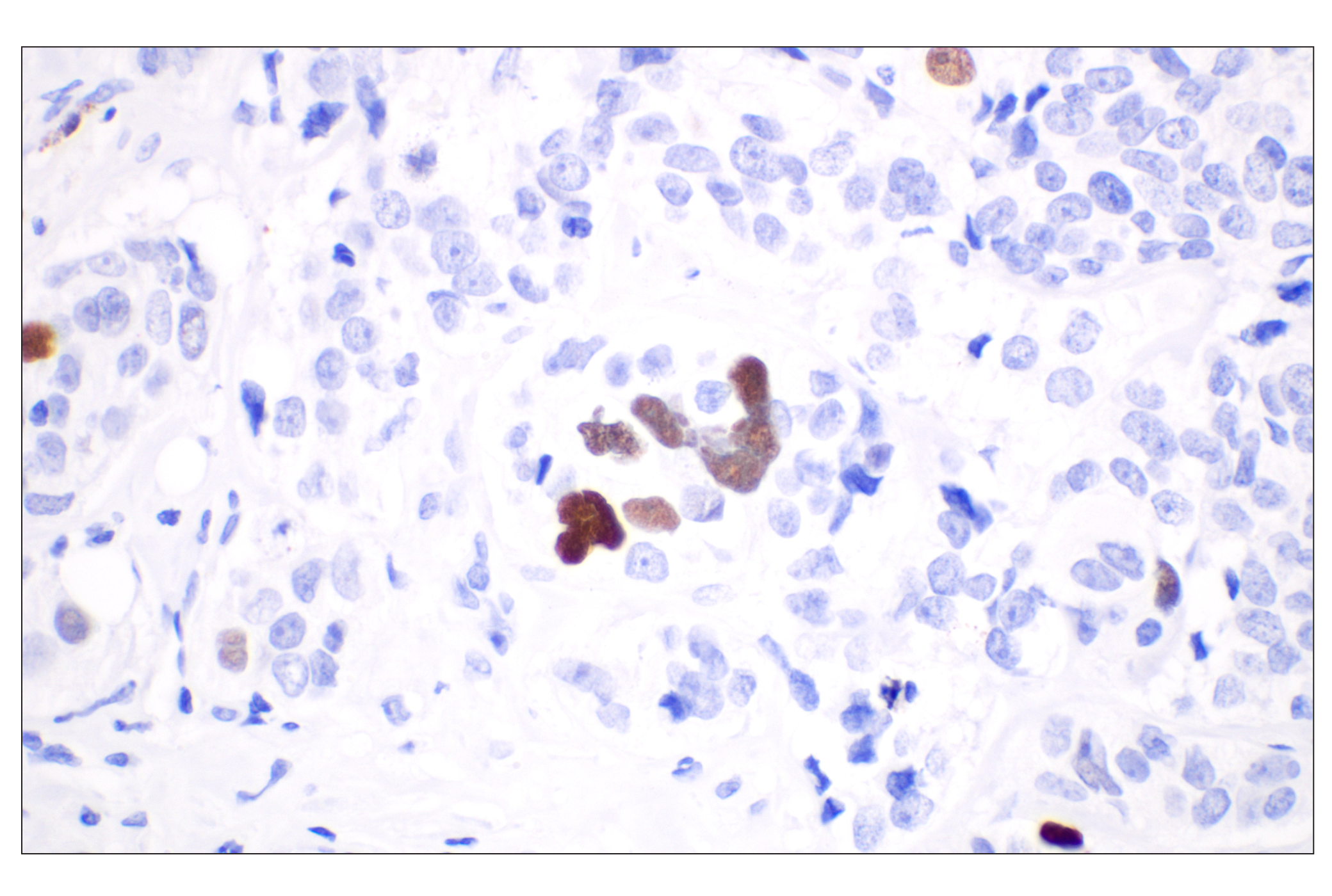 Image 8: Non-Homologous End Joining (NHEJ) DNA Repair Antibody Sampler Kit