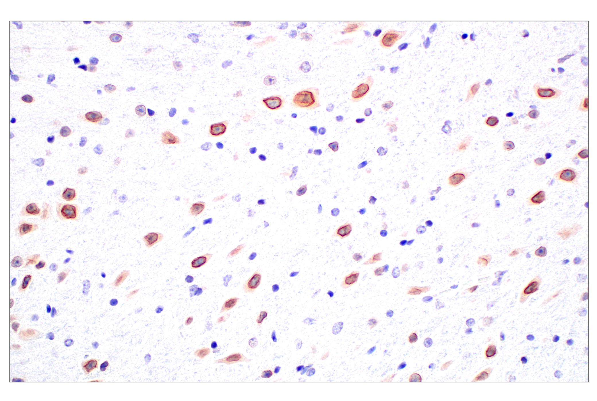 Immunohistochemistry Image 6: POM121 (E3W3J) Rabbit mAb