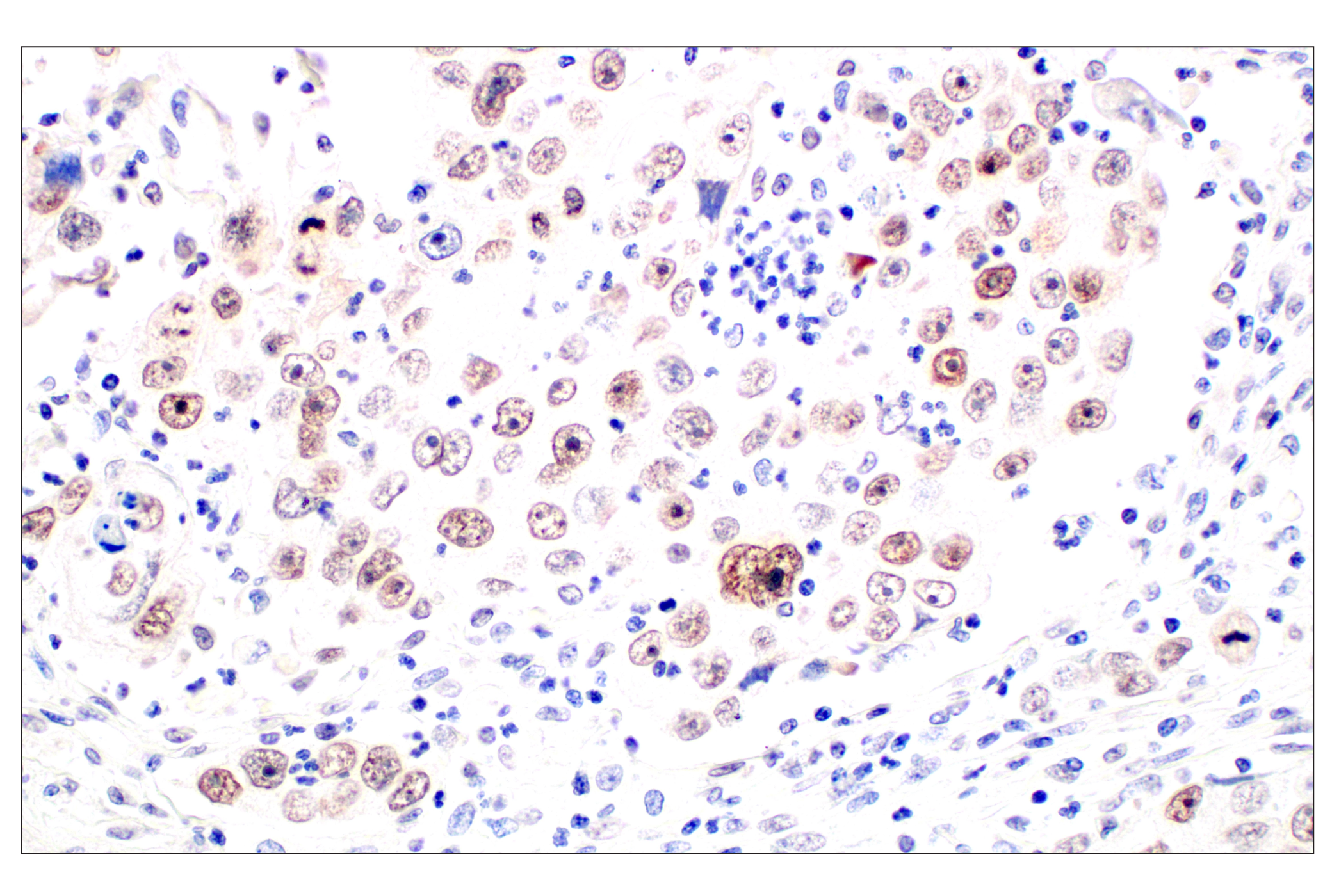 Immunohistochemistry Image 2: POM121 (E3W3J) Rabbit mAb