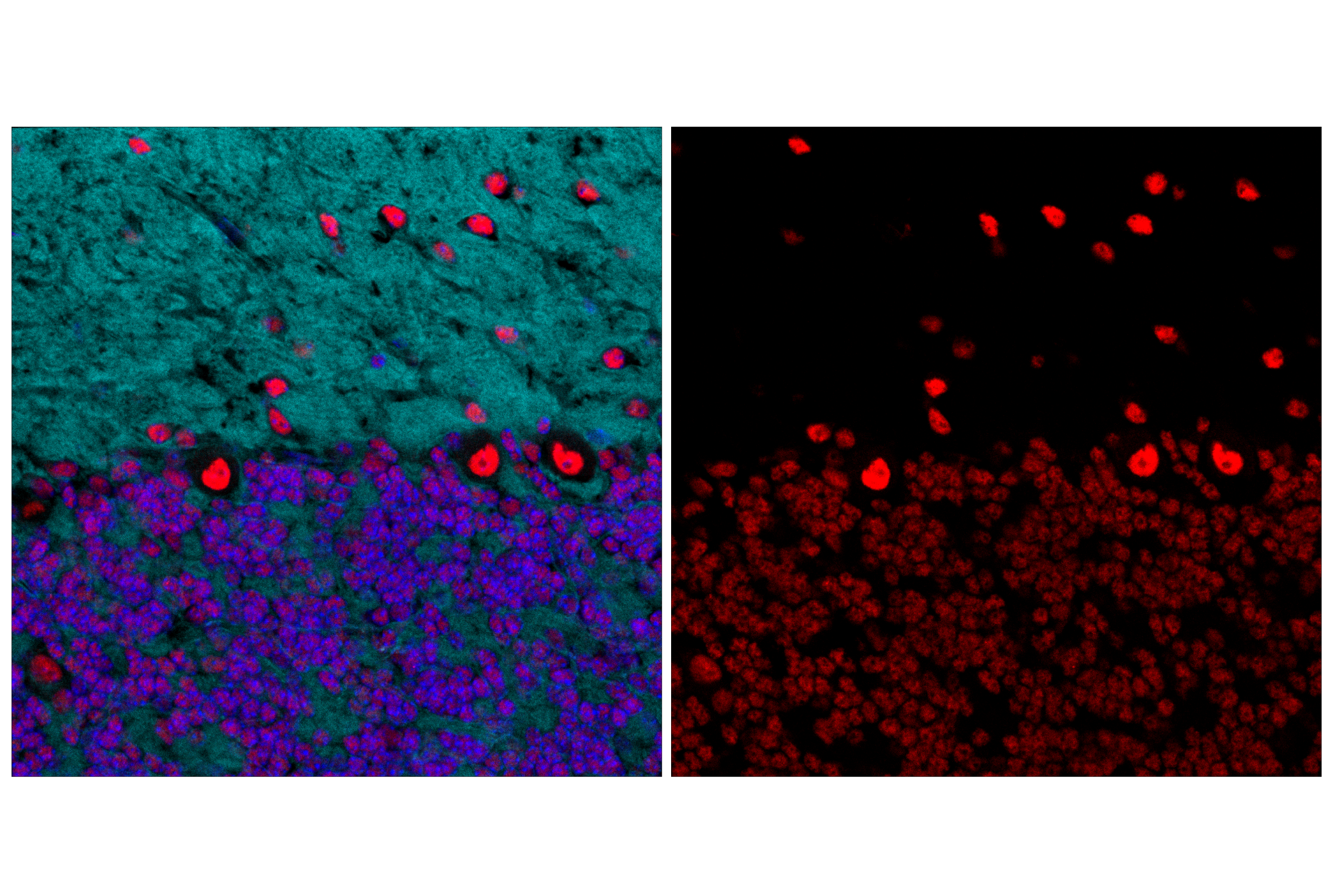 Immunofluorescence Image 1: TDP43 (D9R3L) Rabbit mAb (Alexa Fluor® 555 Conjugate)