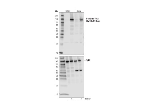  Image 7: IFN (Type I/III) Signaling Pathway Antibody Sampler Kit