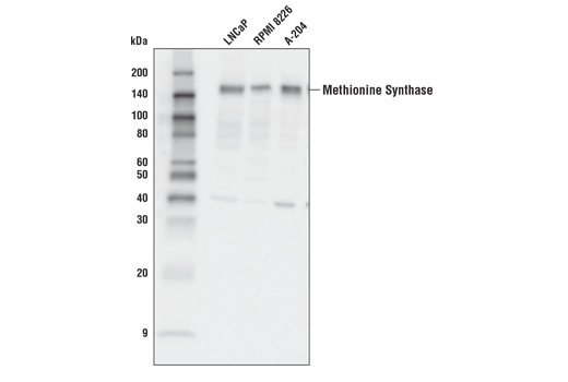 Western Blotting Image 1: Methionine Synthase (D3D6H) Rabbit mAb