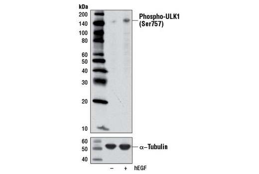 Image 11: ULK1 Antibody Sampler Kit