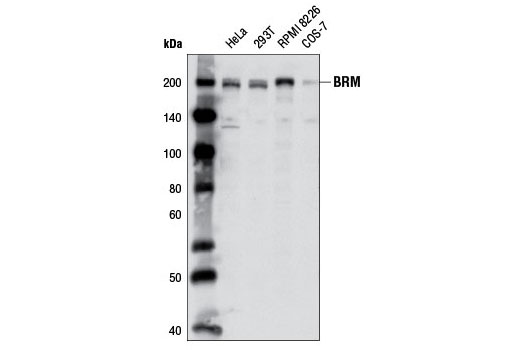 Western Blotting Image 1: BRM Antibody
