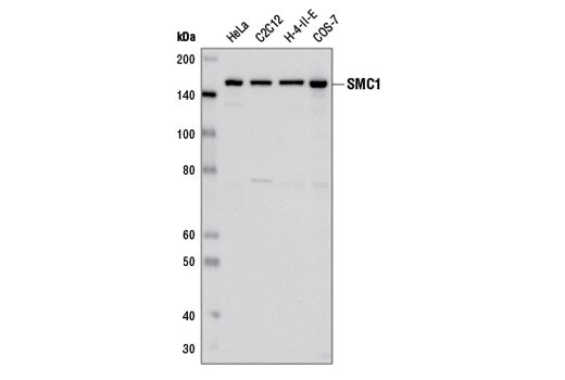 Western Blotting Image 1: SMC1 (8E6) Mouse mAb