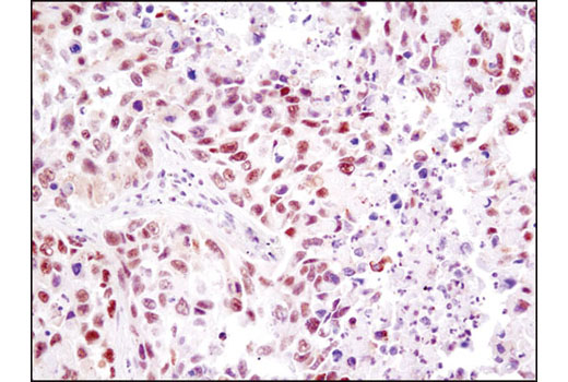 Immunohistochemistry Image 3: HMGB1 (D3E5) Rabbit mAb