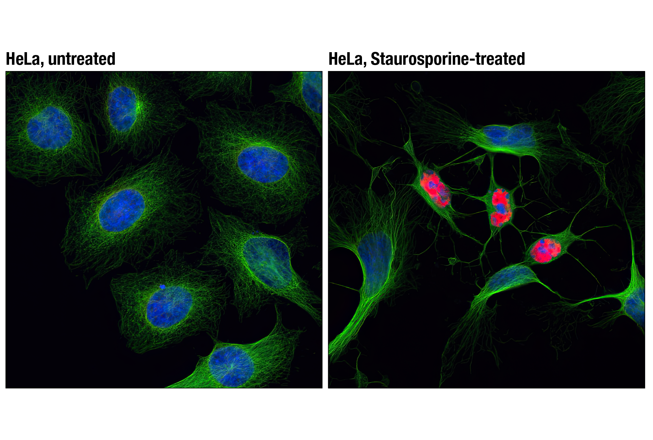 Immunofluorescence Image 1: Cleaved PARP (Asp214) (D64E10) XP® Rabbit mAb (Alexa Fluor® 555 Conjugate)