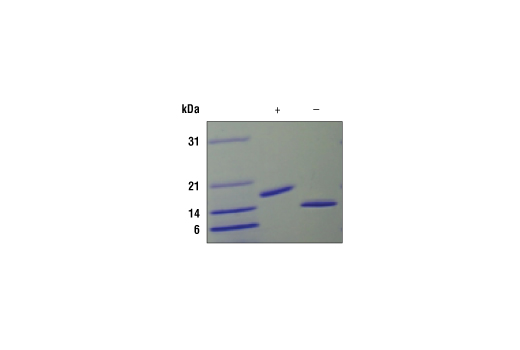 Image 2: Mouse IL-2 Recombinant Protein