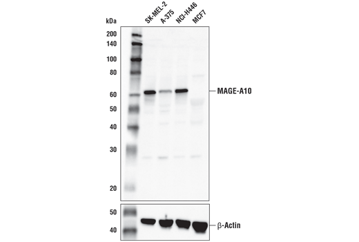 Western Blotting Image 2: MAGE-A10 Antibody