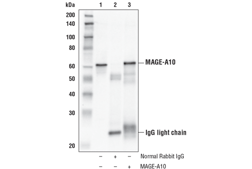 Immunoprecipitation Image 1: MAGE-A10 Antibody