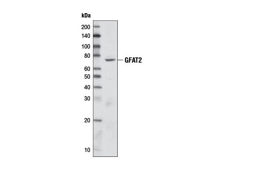  Image 6: Glutamine Metabolism Antibody Sampler Kit